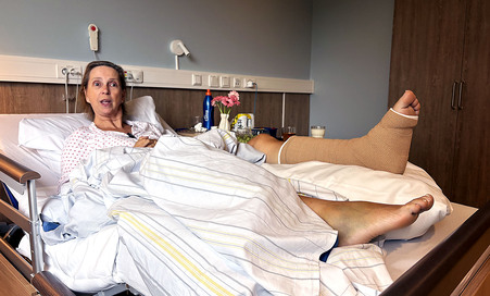 Tove Merete Hørgård i sykeseng med ett forslått og ett brukket bein
