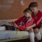 Den dagen 11-årige Yana Stepanenko skulle evakueres, mistet hun i stedet begge beina i et angrep mot jernbanestasjonen i Kramatorsk. Også moren mistet et bein. Nå ligger begge på et sykehus i Lviv vest i Ukraina. (Foto: Emilio Morenatti, AP, NTB)