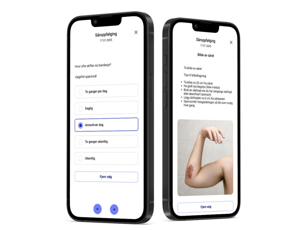 To smarttelefoner som viser ulike skjermbilder fra sår-appen